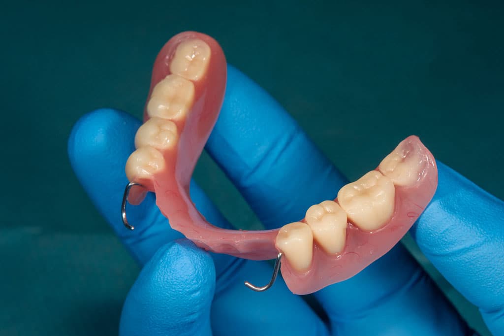 Prótesis dentales digitales en A Coruña
