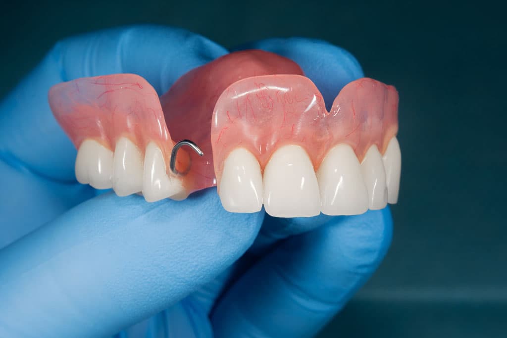 Prótesis dentales removibles en A Coruña